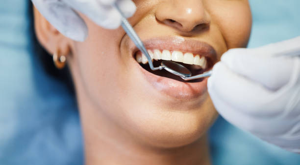 Best Emergency Dentist for Knocked-Out Tooth in Florence, AL