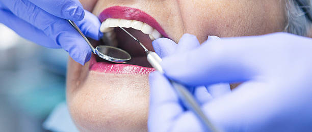 Best Broken or Cracked Tooth Emergency Dentist in Florence, AL